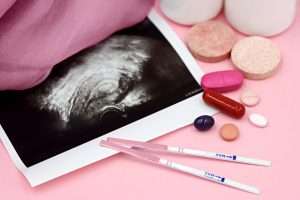 hormone replacement therapy